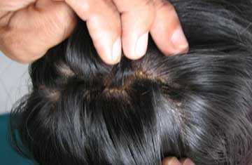 Sự thật sau các vụ tự bốc cháy bí ẩn ở Việt Nam