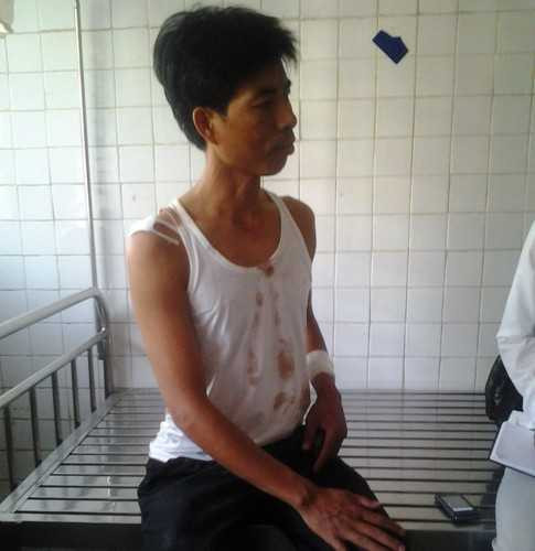 taxi, con nghiện, đánh nhau, vạn xuân