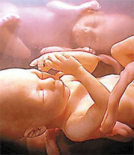 Hình ảnh 4D về cặp song sinh khi còn trong bụng mẹ.