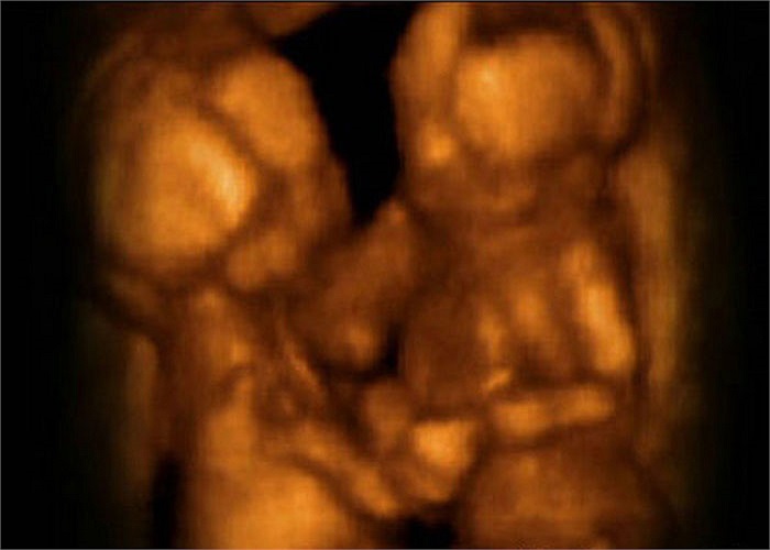 nhưng cũng khá rõ mặt và hình thái.