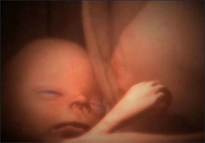 Sờ cả mặt nhau.