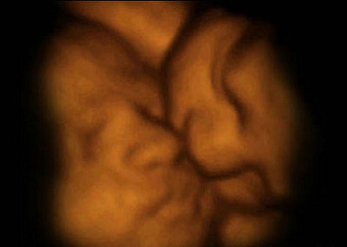 Đây là hình ảnh 3D.