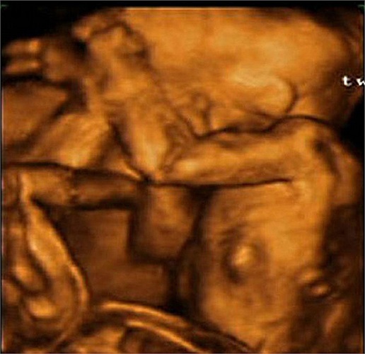 không được rõ nét như hình ảnh 4D