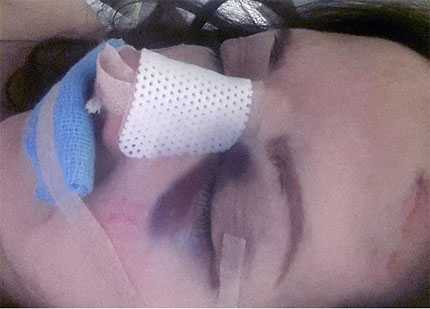 Vì giầy cao gót, sao truyền hình gãy mũi