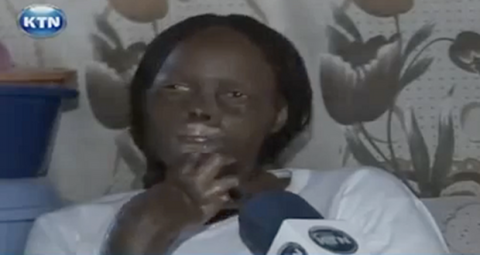 Người vợ bị chồng đốt mặt