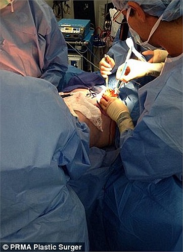 Thông qua trang mạng Twitter, các bác sĩ tại bệnh viện PRMA Plastic Surgery đã mô tả từng bước của tiến trình phẫu thuật cho bệnh nhân, nhằm cho người xem cái nhìn chân thật nhất về trường hợp này.