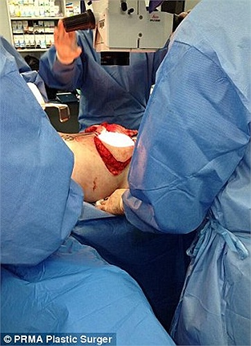 Ca phẫu thuật bắt đầu lúc 9 giờ sáng, còn việc tái tạo hoàn thành trước 5 giờ chiều. Hiện bệnh nhân đang trong tình trạng ổn định, một bác sĩ tại bệnh viện tiết lộ.