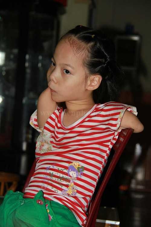 Nguyễn Linh Chi Nick Vujicic Việt Nam