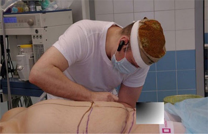 Thông thường, trước khi phẫu thuật, hoặc hút nội soi, bác sĩ phải vẽ để định hình phần da phải cắt bỏ, phần mỡ cần hút.