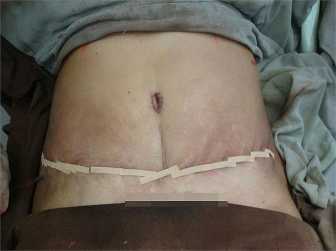 Và dần dần hồi phục.