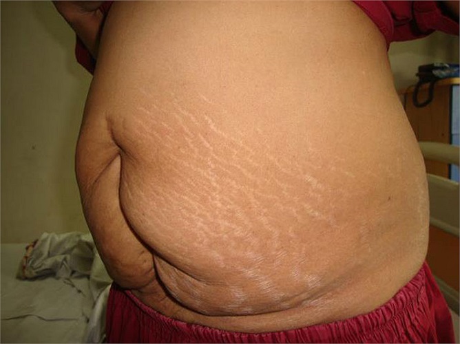 Còn đây là một vòng 2 của quý bà khác.