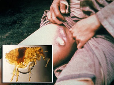 Sốt thỏ Tularemia: Bệnh này được truyền sang cho con người- những đối tượng vốn tiếp xúc với các mô động vật hoặc thông qua vết cắn của các loài bọ ve, bọ chét…