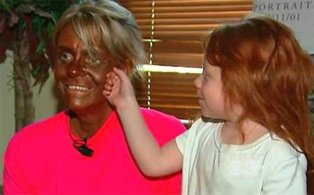 Da trắng miên man biến thành da đen cực xấu