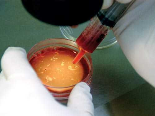 Phát hiện mới: Tinh trùng mê mẩn kim cương