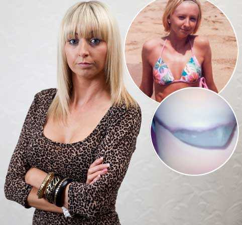 Sốc khi thấy ngực giả lòi ra ngoài cơ thể