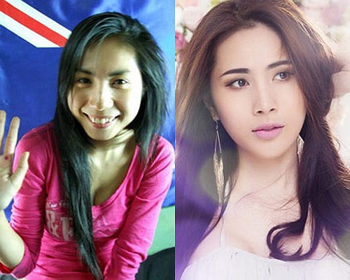 Thủy Tiên ngày trước có khuôn mặt tròn, mũi hơi tẹt. Còn bây giờ, cô có khuôn mặt trái xoan nhỏ nhắn, mũi cao, cằm thon.