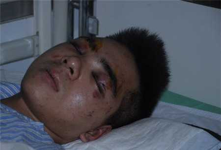 Bạo lực học đường: Một tháng, ba vụ đánh nhau đến chết