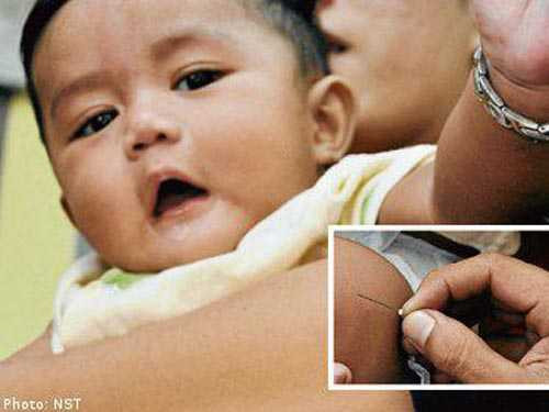 Khó tin những ca dị vật mắc trong cơ thể