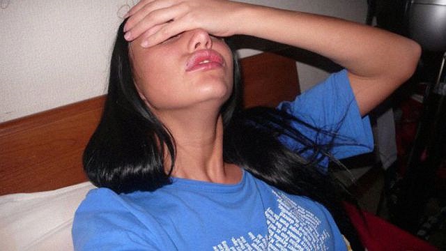 Và cô vẫn phải chấp nhận sống chung với đôi môi biến dạng này vì chưa thể sửa chữa ngay được