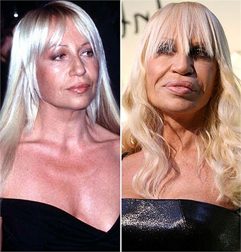 Donatella Versace có thể đã không tưởng tượng được bản thân trở nên già và xấu đến như vậy trước khi quyết định nhờ đến dao kéo nâng cao sắc diện.