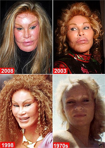 Jocelyn Wildenstein đã trải qua ít nhất 7 cuộc phẫu thuật với chi phí lên tới hơn 4 triệu đô.
