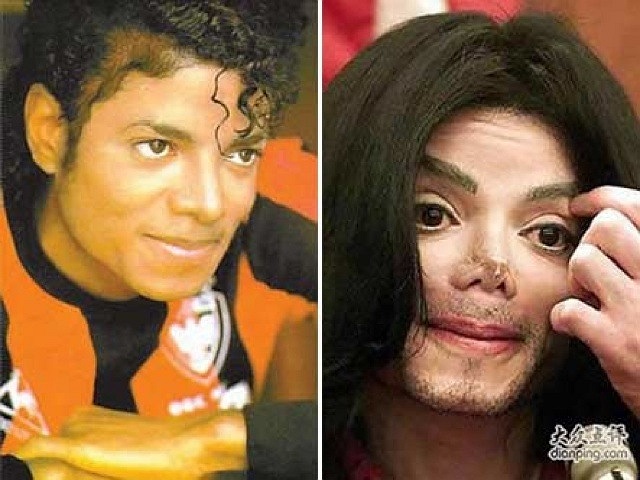 Michael Jackson khi còn sống là một người sùng bái phẫu thuật thẩm mĩ, với việc làm sáng da, nâng mũi, căng da...so với tấm ảnh thời trẻ, gương mặt về sau của ông Hoàng nhạc Pop đã biến đổi hoàn toàn.