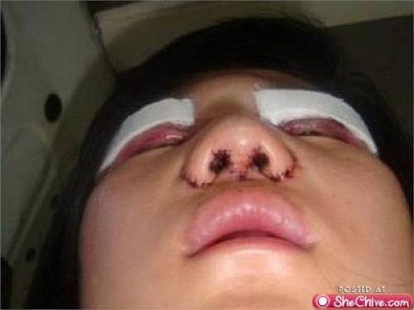 Mắt gần như không mở ra được. Thậm chí còn xấu hơn gương mặt trước đây của cô.