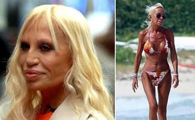 Nhiều người sửng sốt khi bắt gặp Donatella Versace trên bãi biển tháng 9/2009, sau khi nhà thiết kế nổi tiếng giảm cân nghiêm trọng.