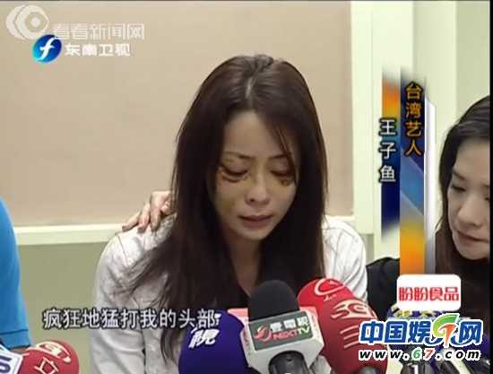 Tiết lộ sốc về chân dài bị đại gia hành hung