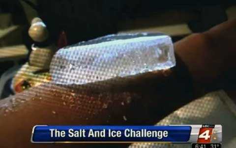 Tự làm bỏng bằng đá và muối, thú vui nguy hiểm của teen