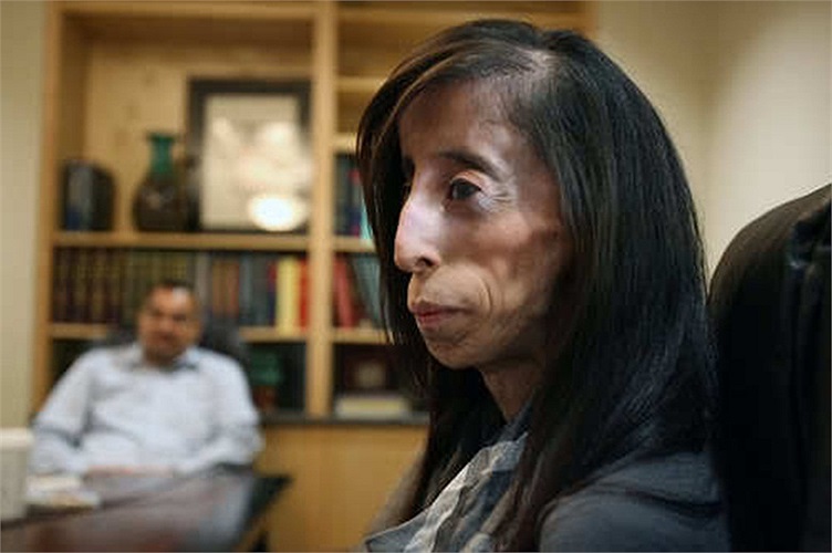 Nhưng Lizze Velasquez không chút mặc cảm, cô vẫn luôn hy vọng trở thành nhà diễn giả giỏi