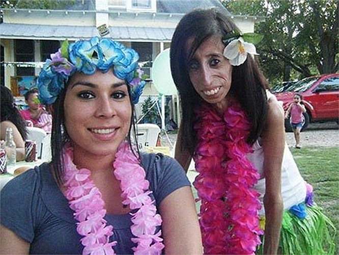 'Tôi cố gắng vượt qua sự tự ti về bản thân để sống tốt hơn', Lizze Velasquez nói