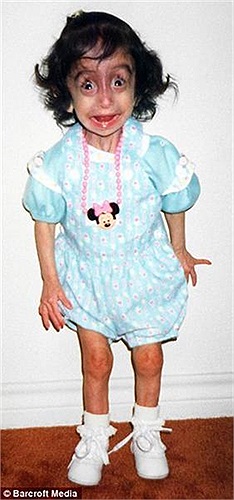 Lizze Velasquez khi còn bé