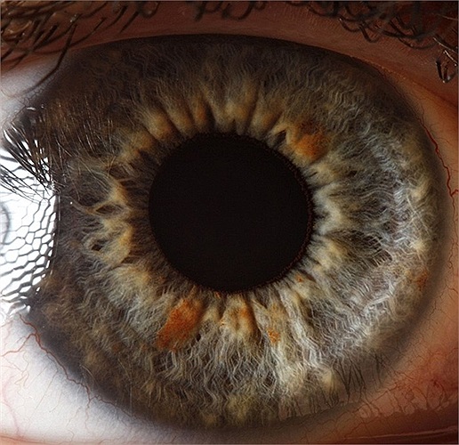 Có thể cửa sổ tâm hồn không hoàn mỹ như chúng ta thường nghĩ