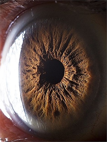 Sâu trong mắt người là những hình ảnh chẳng khác gì núi lửa của một hành tinh xa nôi nào đó