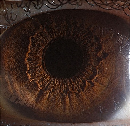 Tâm của nhãn cầu là đồng tử, khu vực hoàn toàn có màu đen