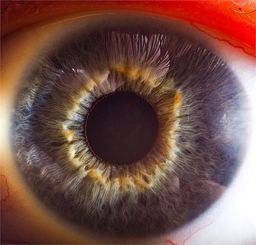 Đồng tử nở rộng khi bắt gặp ánh sáng của đèn flash