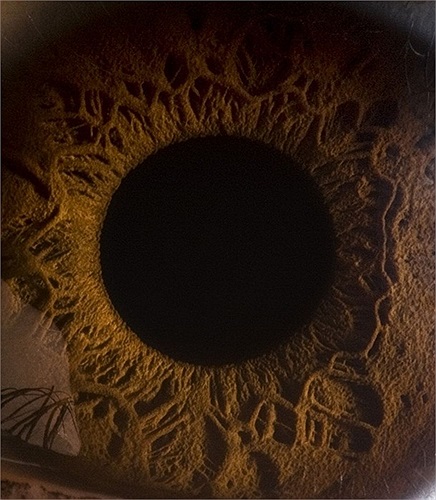 Khi chụp gần đồng tử trông như những hố đen trong vũ trụ, rất sâu và hút ánh sáng