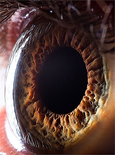 Qua lớp thủy tinh thể mỏng và trong suốt ánh sáng sẽ đi thẳng đến võng mạc