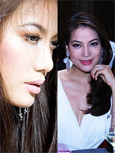 So sánh hình ảnh chiếc cằm của Trương Ngọc Ánh cách đây vài năm và hiện tại có thể thấy rõ sự thay đổi này.