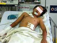 Ném mạnh, bom phát nổ: 4 trẻ tử vong, 2 trẻ nguy kịch