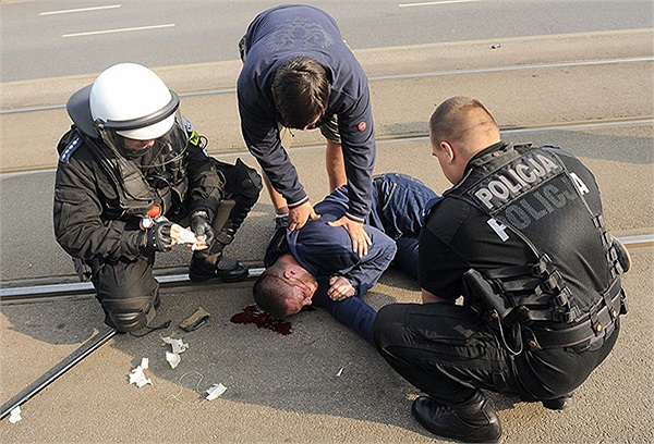 Cảnh sát Ba Lan phải rất kiên quyết mới giải tán được 'cuộc chiến' này. Hàng trăm người bị thương, hàng chục người bị bắt