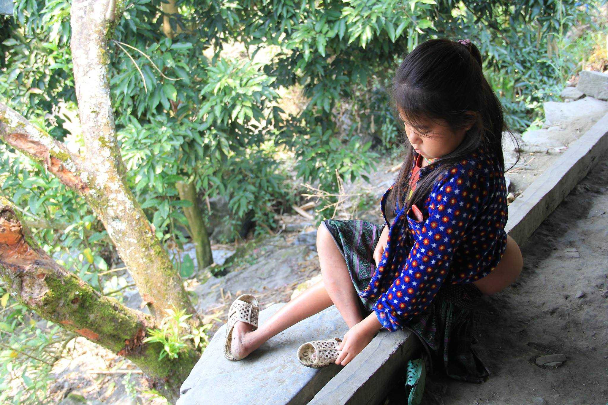 Đôi lúc bé nhìn xuống đôi chân bị teo do khối u không lồ đã hút hết chất khiến đôi chân không thể phát triển đc