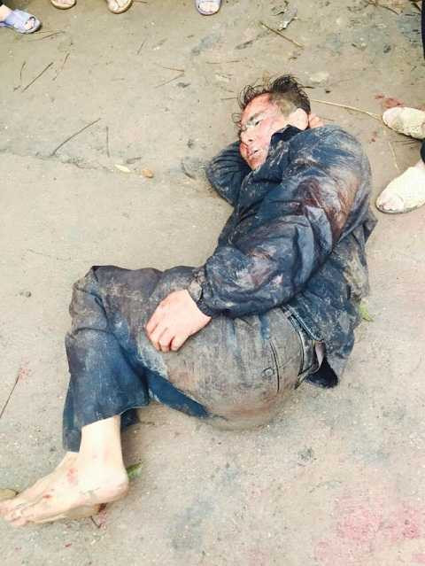 Đối tượng trộm chó bị người dân bắt giữ Đối tượng trộm chó bị người dân bắt giữ