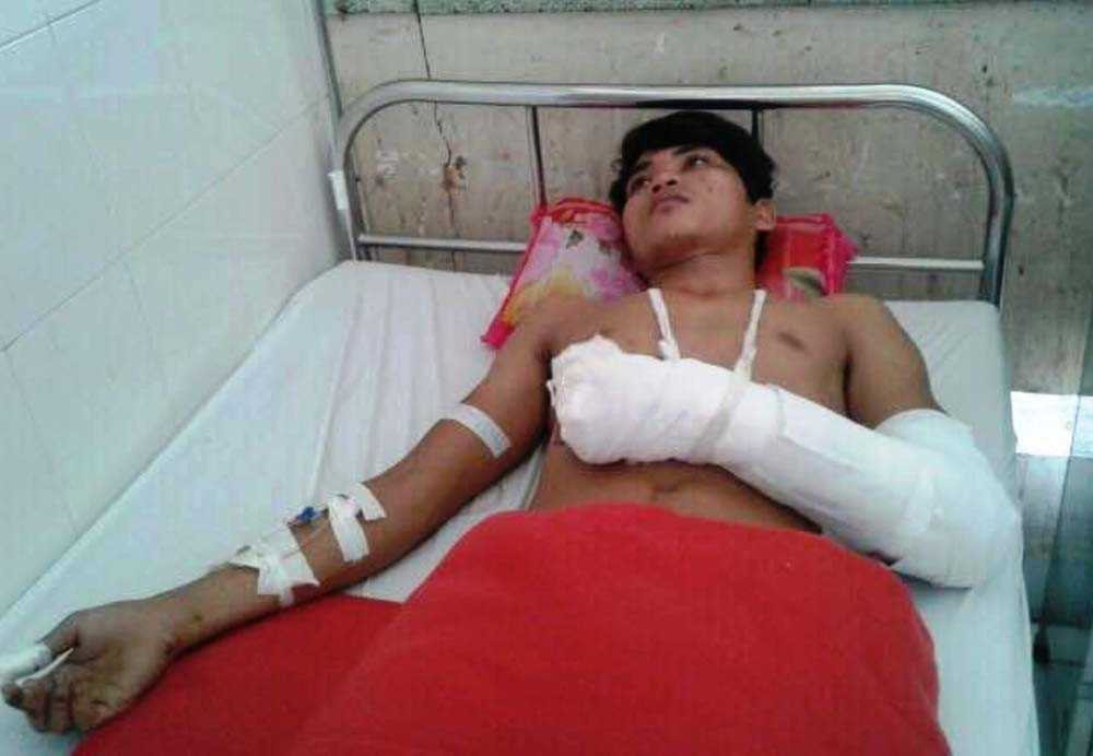 Anh Tính với vết thương trên người