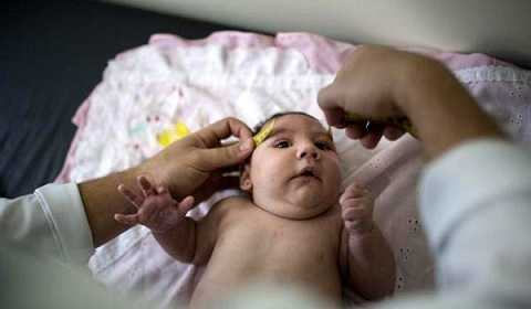 Các bác sĩ siêu âm của Việt Nam hoàn toàn có thể đo được chuẩn kích thước đầu của trẻ sơ sinh Các bác sĩ siêu âm của Việt Nam hoàn toàn có thể đo được chuẩn kích thước đầu của trẻ sơ sinh