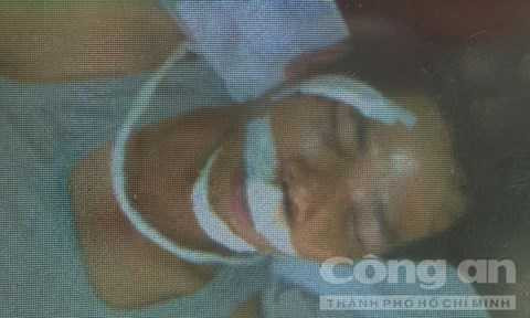 Anh Mai Văn Lê bị đánh bất tỉnh đang điều trị tại bệnh viện 175 - Ảnh: Tuấn Thành