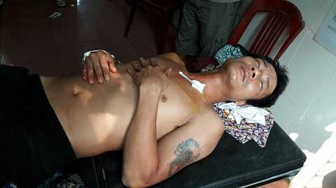 Anh Quảng sau khi thoát khỏi lưỡi dao đã hoảng sợ, mê man bất tỉnh