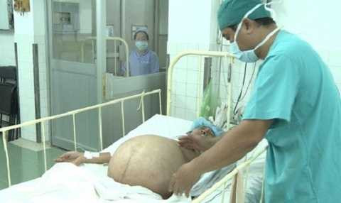 Bụng bệnh nhân chướng căng trước khi bước vào ca phẫu thuật Bụng bệnh nhân chướng căng trước khi bước vào ca phẫu thuật