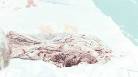 Vỏ bướu khổng lồ nặng gần 3kg Vỏ bướu khổng lồ nặng gần 3kg